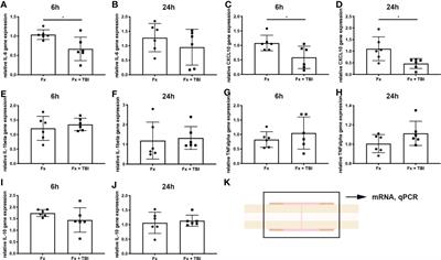 Altered early immune response after fracture and traumatic brain injury